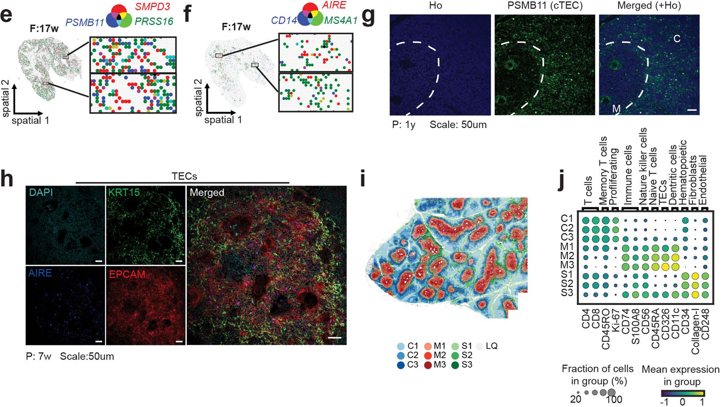 Figure 2. Spatial geopositioning of human thymic niches across age.